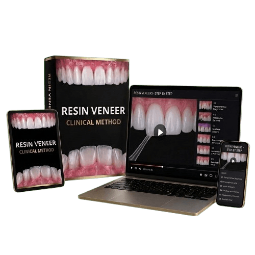 Resin Veneer Clinical Method — print, tablet, laptop, and mobile versions