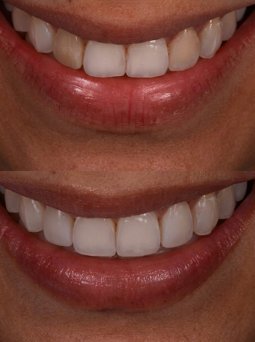 Clinical case by Dr. Marcus Vance