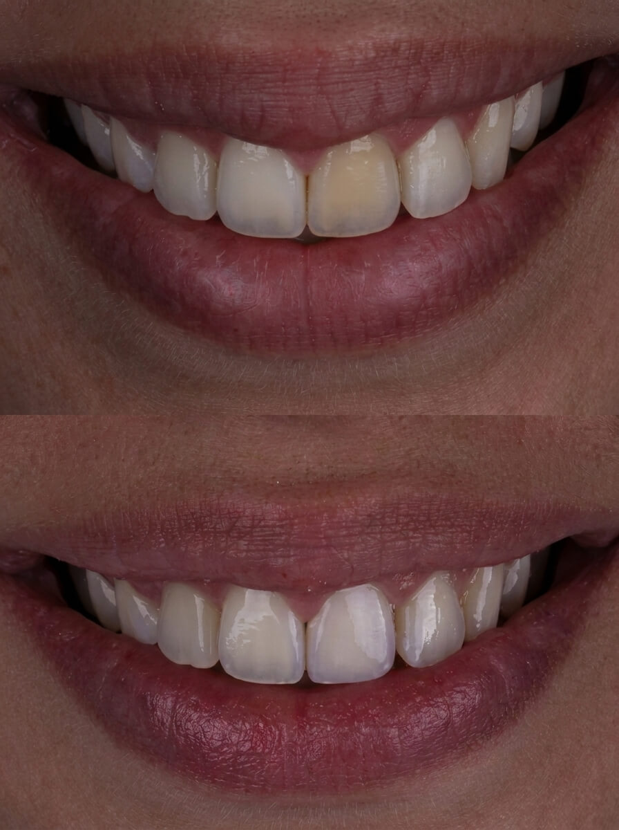 Clinical case by Dr. Nathan Patel